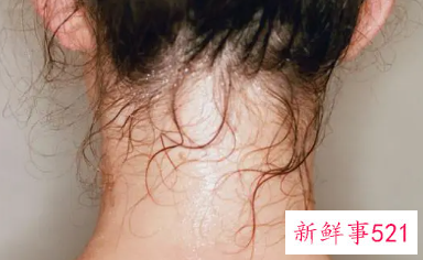 女人脸上爱出汗好事还是坏事