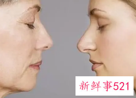 怎样补充脸部的胶原蛋白