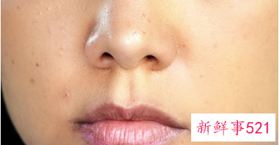 如何才能不做斑女郎拥有嫩白瓷肌呢美容