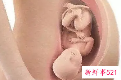 胎宝宝入盆是什么感觉
