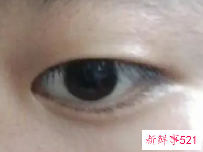 单眼皮的眼型有哪些