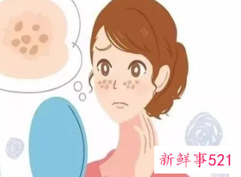 斑点如何淡化的小妙招