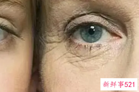 去细纹的方法