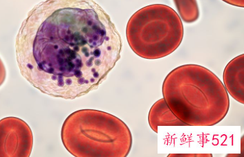 贫血都有哪些症状