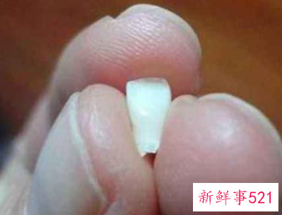 梦见牙齿全部掉了牙齿吐出一把