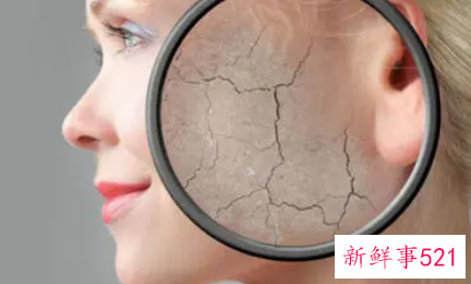 脸部皮肤缺水怎么办