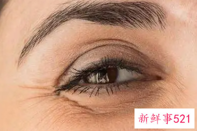 女人去皱纹有哪些方法