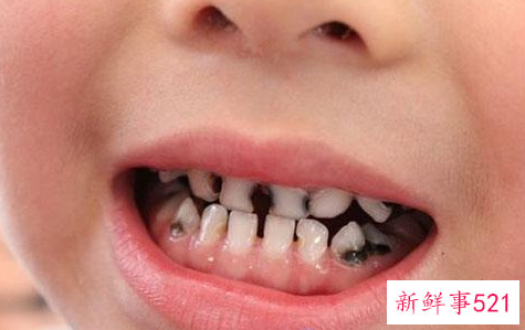 想给宝宝健康的牙齿该怎么做