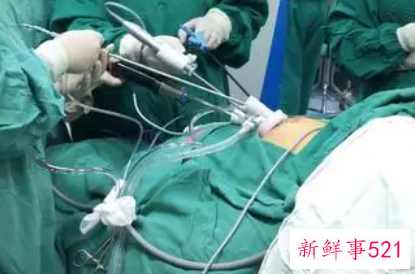 微创全切子宫手术弊端是什么