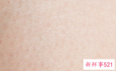 脸上总是出现白色的死皮