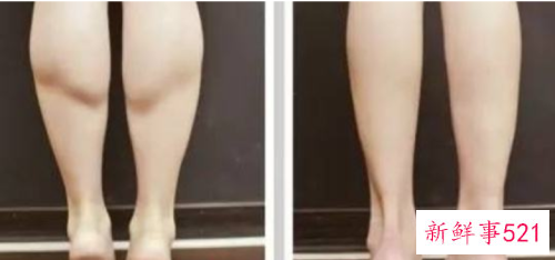 教你如何正确跑步减去讨厌的萝卜腿