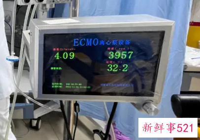 首款国产ECMO研发成功