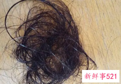 女生掉头发怎么办