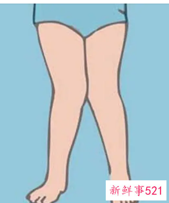 怎么有效改善小腿外翻