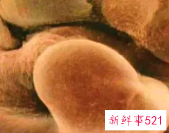 正常的胚胎很坚强