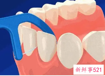 为什么中国人不用牙线