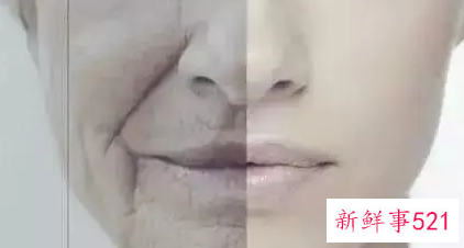 面部抗衰的专业知识