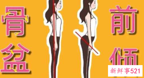 怎么判断自己骨盆前倾