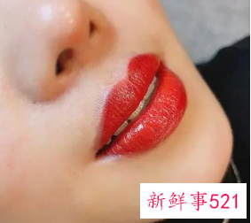 纹唇三年后很丑图片