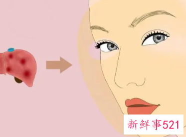 梦见脸腊黄有什么征兆