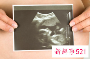 怀孕中期怎么看男女