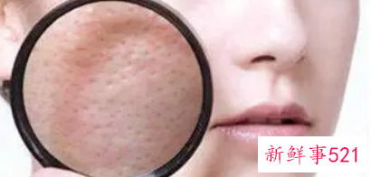 脸部皮肤粗糙小妙招