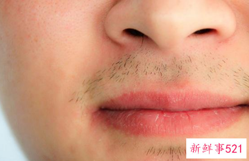 男性荷尔蒙分泌旺盛的表现