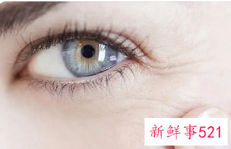 去眼角纹最好的办法