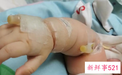 新生儿的危险期是几天