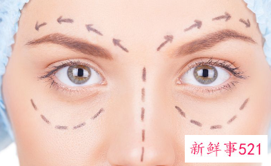 泪沟没办法恢复了吗