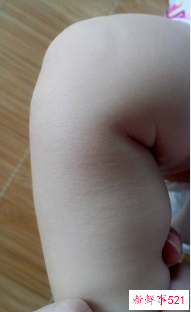 宝宝皮肤干燥要怎么做