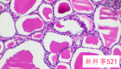 霉菌都是对人体不利的吗