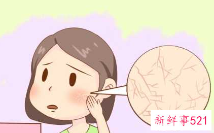 补水保湿方法解决肌肤缺水带来的困扰