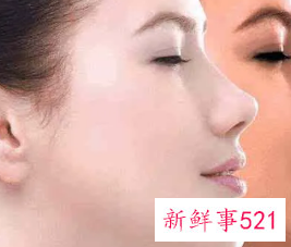 脸晒黑了怎么补救回来