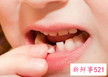 梦见牙齿全部脱落并吐出来又长出新牙