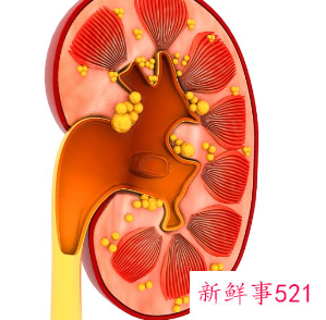 多囊肾婴儿出生一切正常