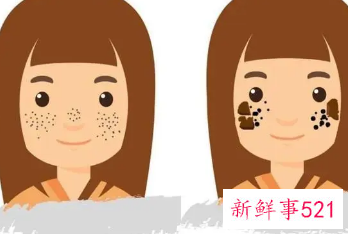 16岁可以点雀斑吗