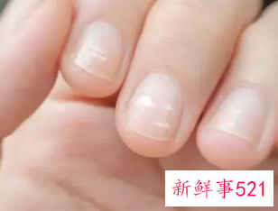 手指甲上有小点点是什么原因