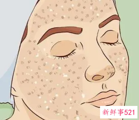 面部去角质的方法与步骤详解