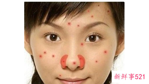 脸上长痘对应五脏示意图