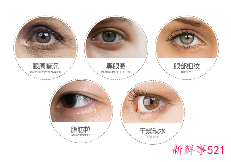 教你不同眼部问题的眼膜选择方法