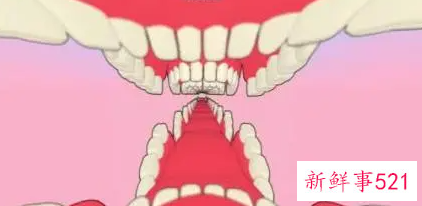 长智齿要怎么止疼