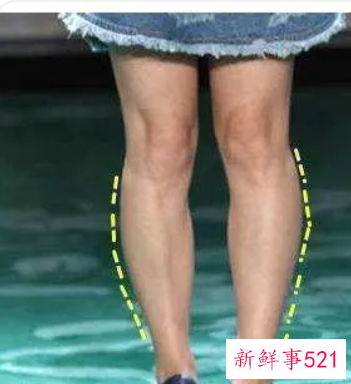 怎么有效改善小腿外翻