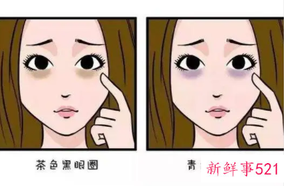 黑眼圈和眼袋怎么样消除