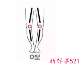 男士o型腿穿什么裤子好看图片