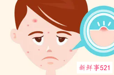 有哪些让肌肤变柔嫩的方法