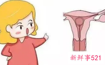 刚取环第一个月容易怀孕吗