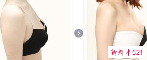 隆胸需要注意什么