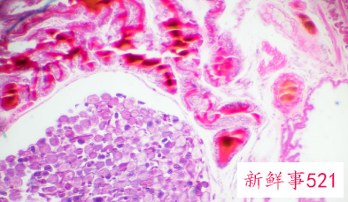 霉菌都是对人体不利的吗