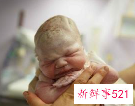 冬季新生儿护理知识大全